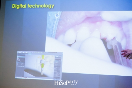 รักษารากฟันเทียมแบบตรงจุด ด้วยเทคนิค Computer Guided Implant Surgery ที่โรงพยาบาลกรุงเทพ